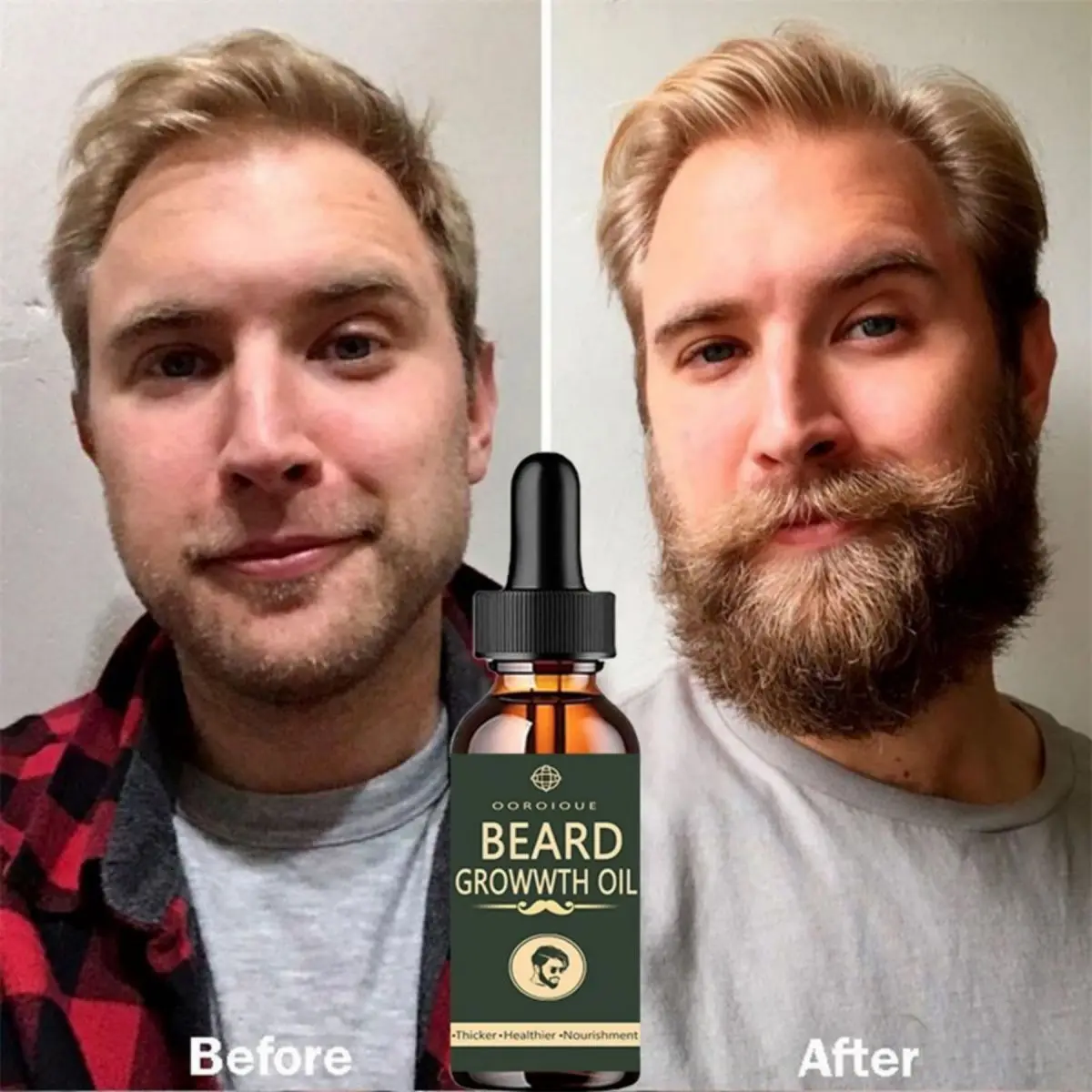 Caffeine Hair Serum - 男性のための急速なあごひげ成長オイル,自然な髪の成長血清,髪の再生,プロのケラチン