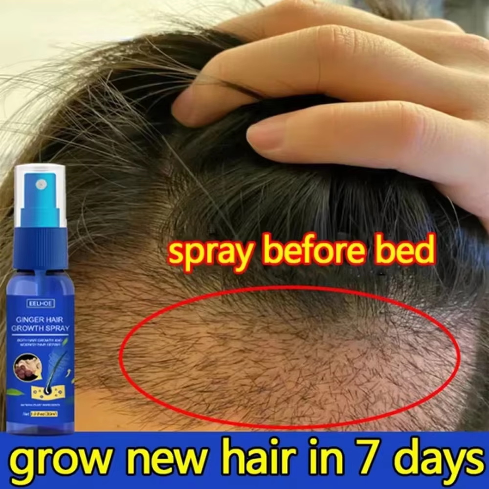 Hair Care Growth - 速効性ジンジャーヘアグローススプレー、毛根育成、脱毛防止、育毛セラム、頭皮ダメージ修復、栄養ケア製品、女性男性用