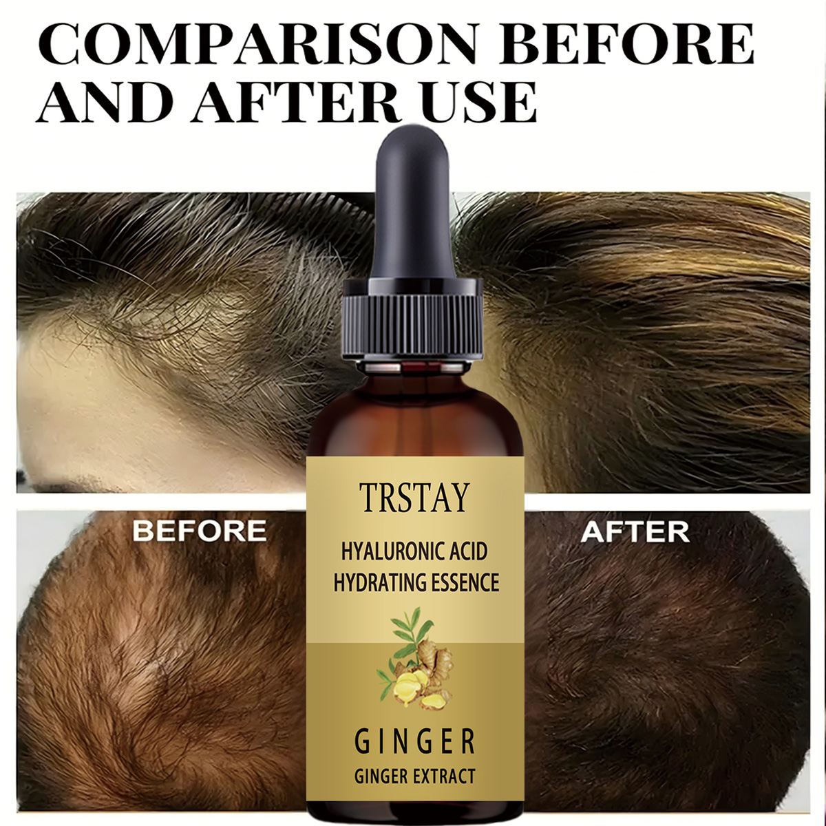 育毛血清抗脱毛予防脱毛症液体ダメージ毛修復成長が速くなる - Caffeine Hair Serum のレビューと価格
