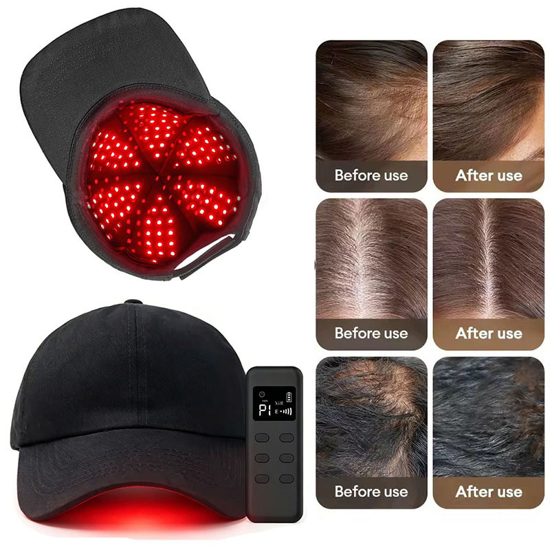 660nm 940nm光 142グループ/284ビームLED - Hair Care Wella のレビューと価格