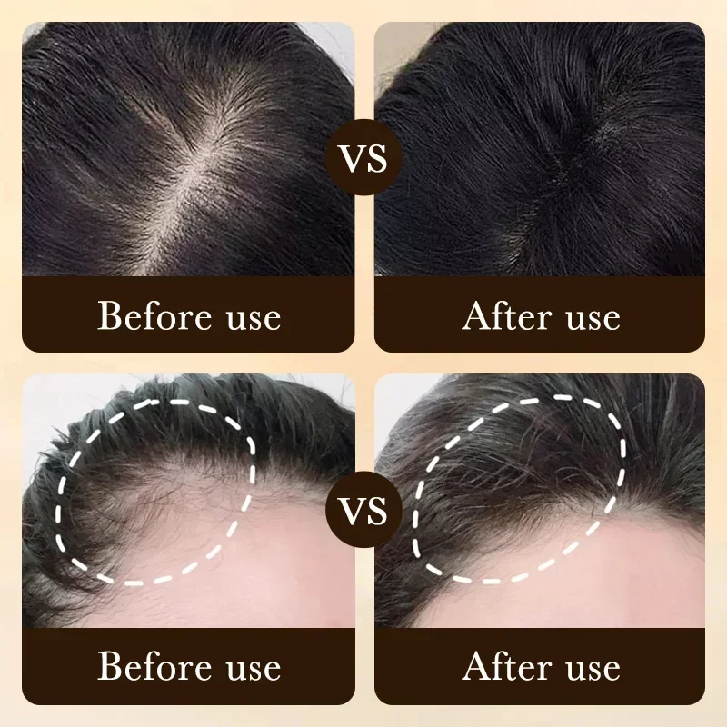 ビオチン配合育毛オイル製品、頭皮マッサージトリートメント、脱 - Caffeine Hair Serum のレビューと価格