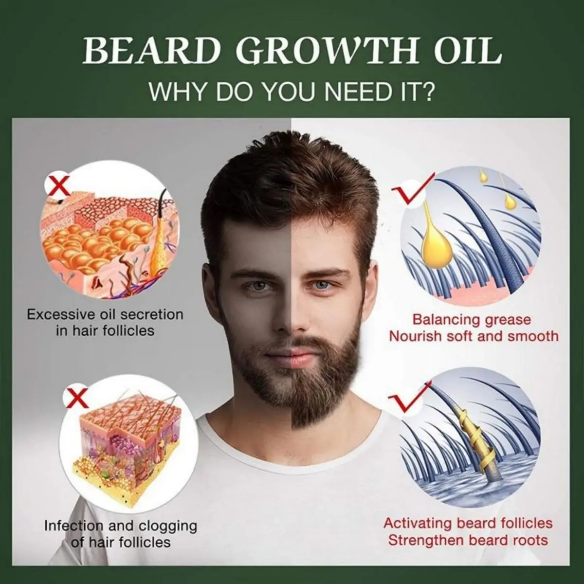 男性のための急速なあごひげ成長オイル,自然な髪の成長血清,髪 - Caffeine Hair Serum のレビューと価格