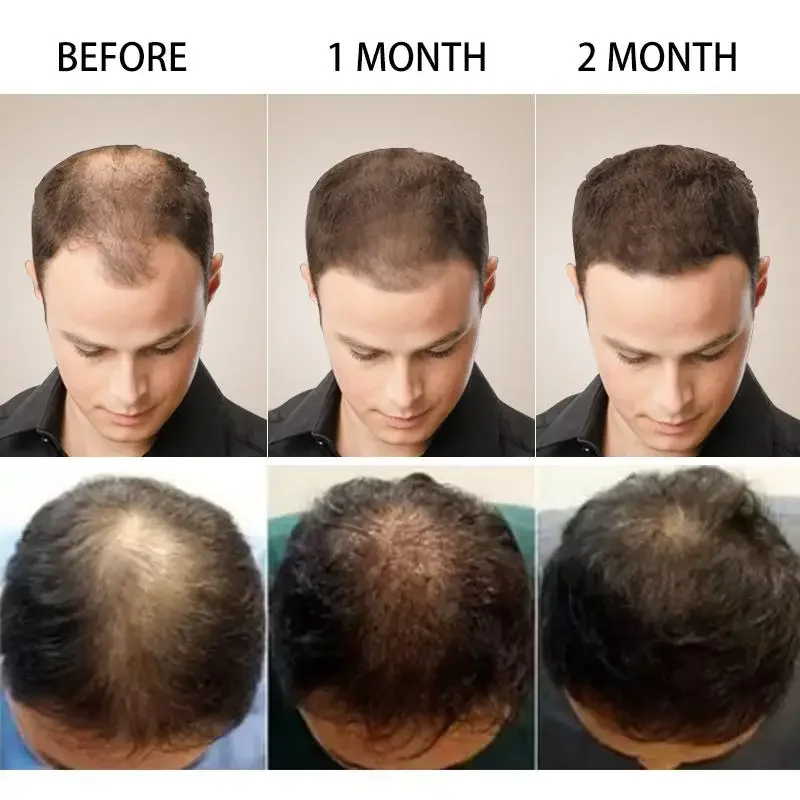 育毛ジンジャー高速成長髪エッセンシャルオイルヘアケア損失防止 - Caffeine Hair Serum のレビューと価格